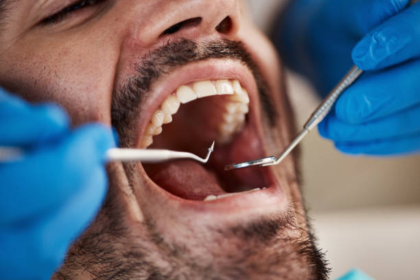 Best Knocked-Out Tooth Emergency  in Big Bear Lake, CA